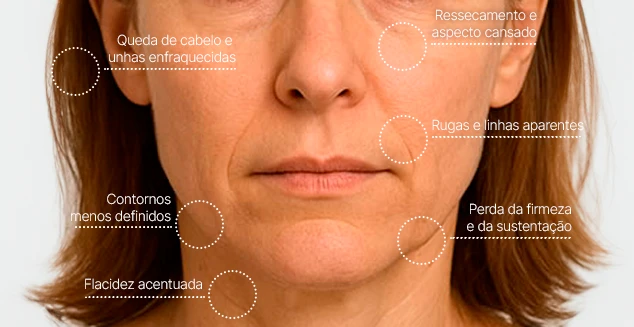 pontos-canetas.webp