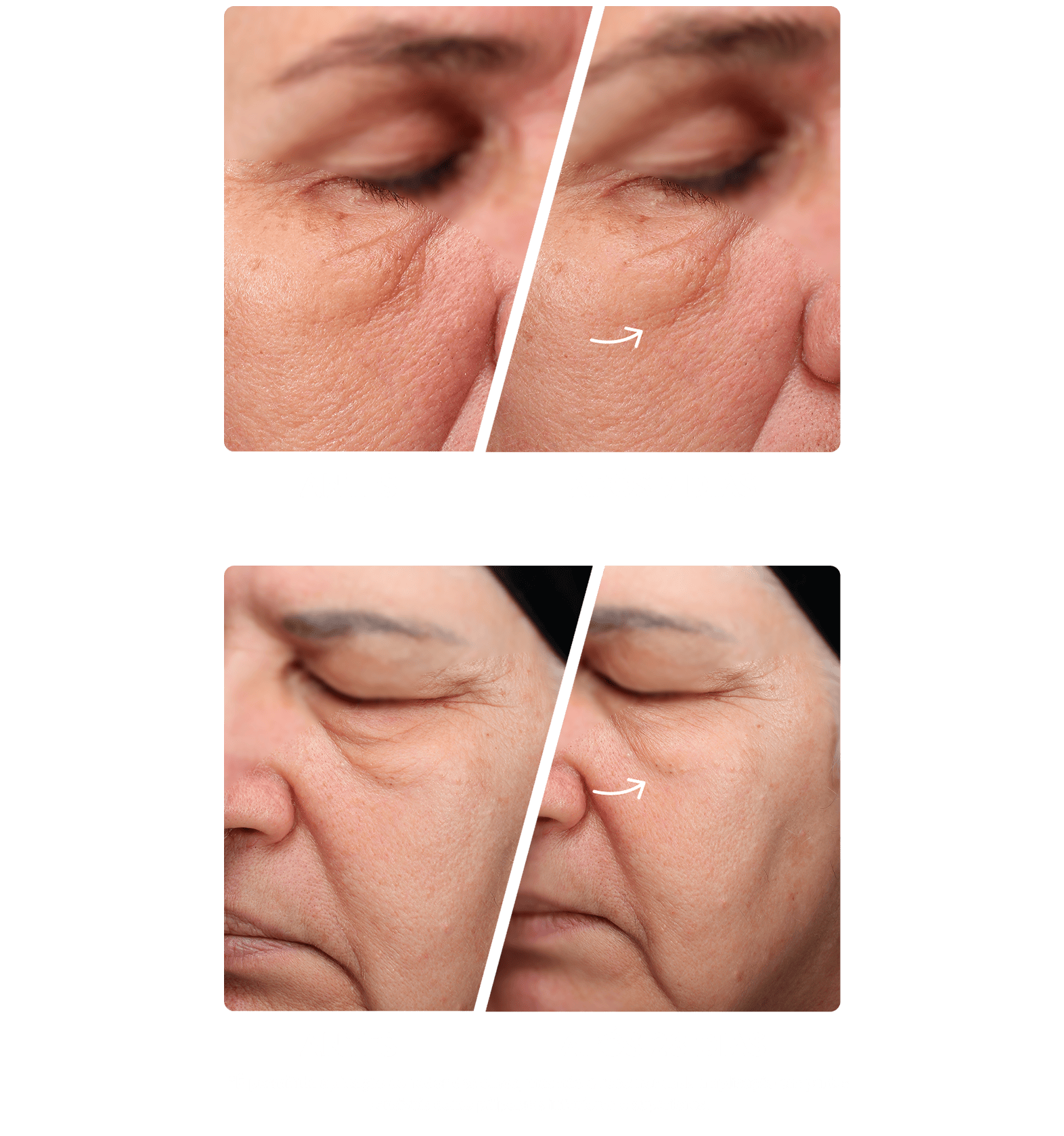 antesedepois-mobile.png