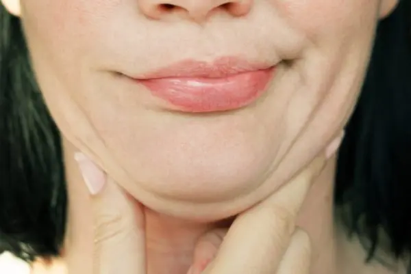 Flacidez facial — dicas e produtos ADCOS