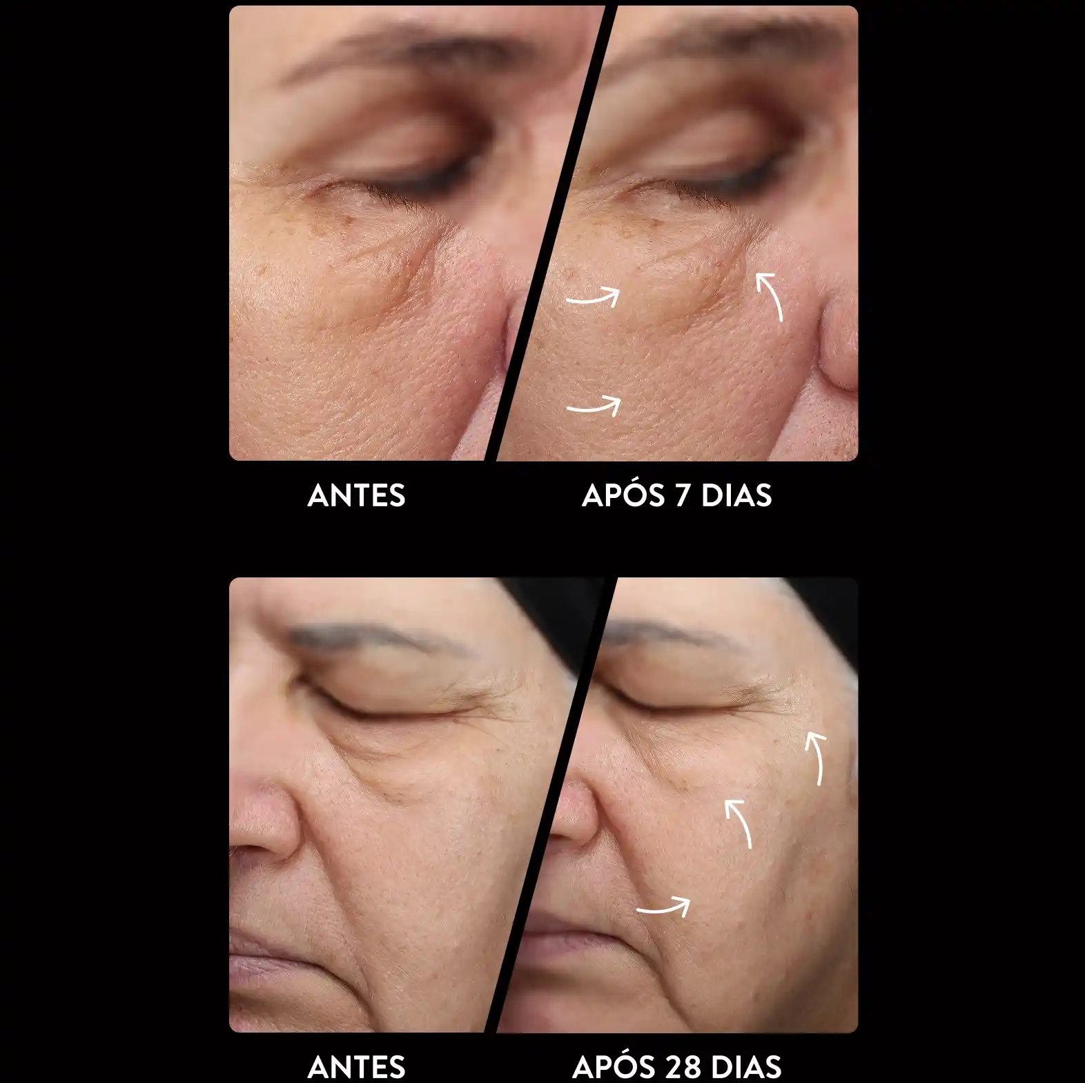 antes depois mobile.webp